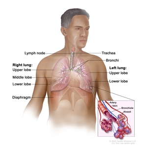 Respiratory system anatomy; drawing shows the right lung with the upper, 中间, 下叶, 左肺上下叶, 还有气管, 支气管, 淋巴结, 和隔膜. 图示细支气管、肺泡、动脉和静脉.