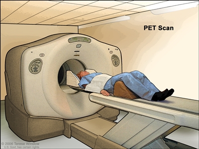 正电子发射断层扫描; drawing shows patient lying on table that slides through the PET machine.