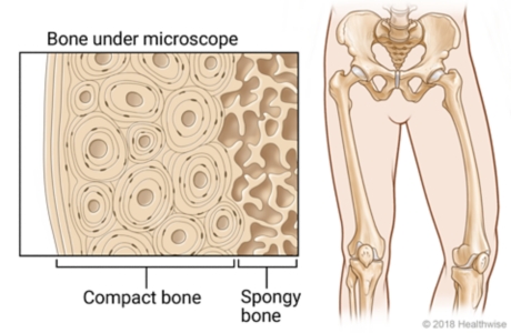 Cross-section view of bone under microscope, showing outer compact bone and inner spongy bone