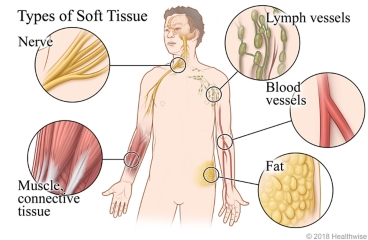 Types of soft tissue, including nerves, muscle and connective tissue, lymph vessels, blood vessels, and fat