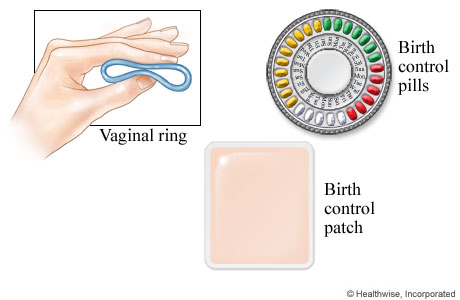 Vaginal ring, birth control pills, and birth control patch