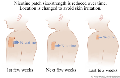 How a nicotine patch is used.