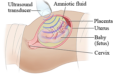 Fetal ultrasound, showing amniotic fluid, placenta, uterus, fetus, and cervix