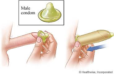 How to put on a male condom