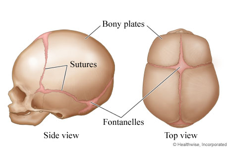 Picture of skull sutures and bony plates in fetuses and infants