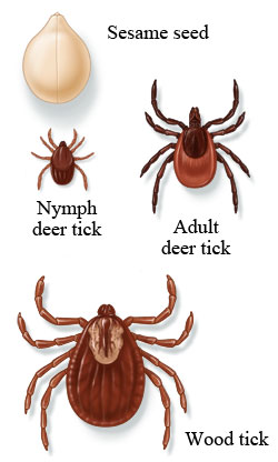 Types of ticks compared to the size of a sesame seed