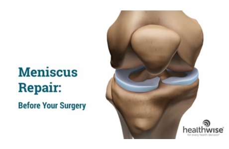 Meniscus Repair: Before Your Surgery