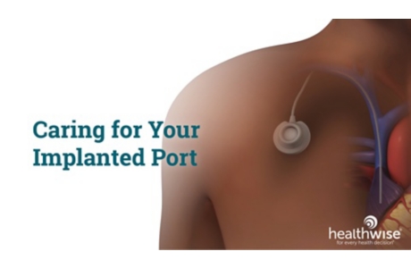 Caring for Your Implanted Port