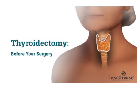 Thyroidectomy: Before Surgery