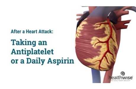 After a Heart Attack: Taking an Aspirin or Antiplatelet
