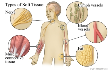 Types of soft tissue, including nerves, muscle and connective tissue, lymph vessels, blood vessels, and fat