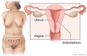 Female reproductive organs in pelvis, with close-up of uterus, endometrium, and vagina.