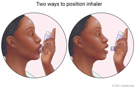Two positions shown for using inhaler, one in mouth with lips closed around mouthpiece, and one placed 1 to 2 inches from open mouth.