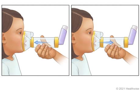 Adult holding mask spacer over child's nose and mouth, while child breathes in medicine from spacer.