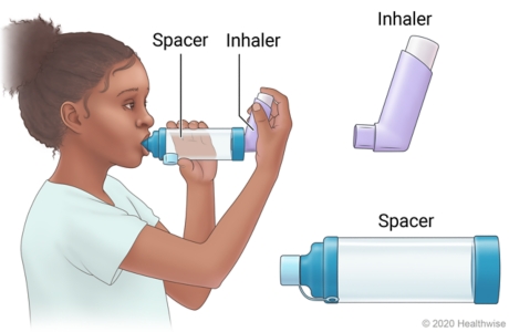Child using inhaler with attached spacer, with end of spacer in mouth while holding spacer with one hand and inhaler with other.