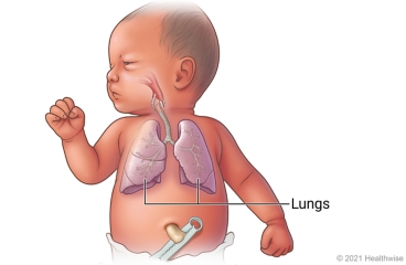 Respiratory system of newborn baby, including lungs and airways to lungs.