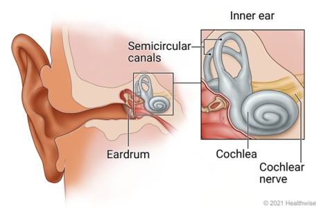 The ear, showing inner ear next to eardrum, with close-up of inner ear and semicircular canals, cochlea, and cochlear nerve.