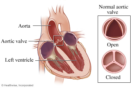 Location of aortic valve in heart and detail of open and closed valve