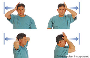 Picture of the hands-on-head strengthening exercise