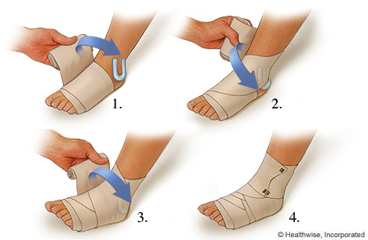 Wrapping a sprained ankle with a compression bandage