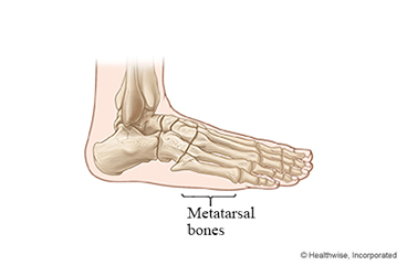 Metatarsal bones in the foot.