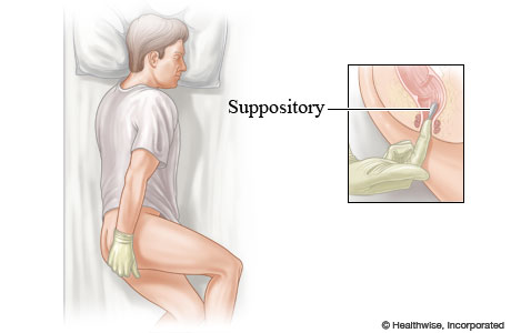 How to use a suppository