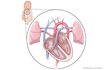 Image of fetal heart circulation