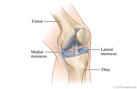 Skeletal view of left knee, showing the meniscus on the outer (lateral) and inner (medial) sides of the knee