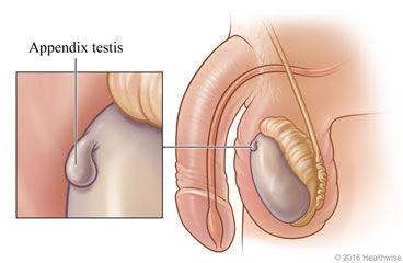 Piece of tissue attached to the testicle, with detail