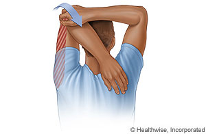 Picture of triceps stretch