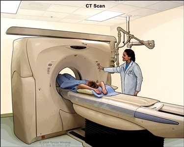 Computed tomography (CT) scan of the abdomen; drawing shows the patient on a table that slides through the CT machine, which takes x-ray pictures of the inside of the body.