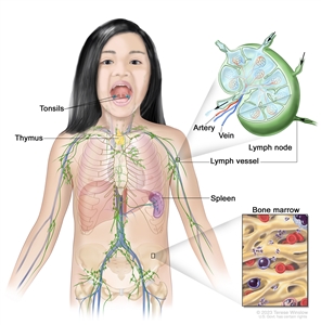 Lymph system; drawing shows the tonsils, thymus, spleen, bone marrow, lymph vessels, and lymph nodes. One inset shows the inside structure of a lymph node and the attached lymph vessels with arrows showing how the lymph (clear, watery fluid) moves into and out of the lymph node. Another inset shows a close up of bone marrow with blood cells.