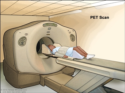 Positron emission tomography (PET) scan; drawing shows a child lying on table that slides through the PET scanner.