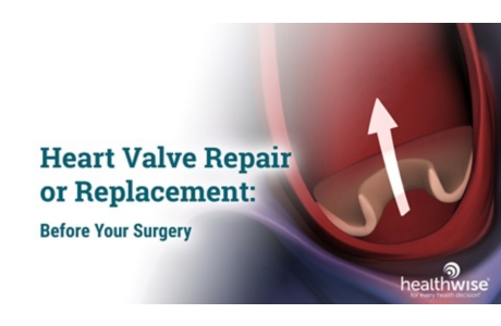 Heart Valve Repair or Replacement: Before Your Surgery