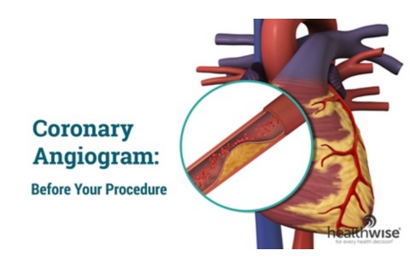 Coronary Angiogram: Before Your Procedure