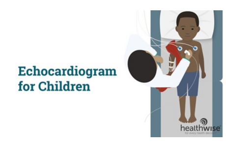 Echocardiogram for Children
