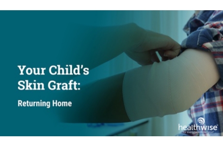 Your Child's Skin Graft: Returning Home