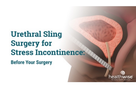 Urethral Sling Surgery for Stress Incontinence: Before Your Surgery