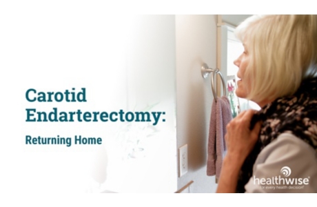 Carotid Endarterectomy: Returning Home