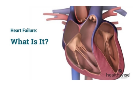 Heart Failure: What Is It?