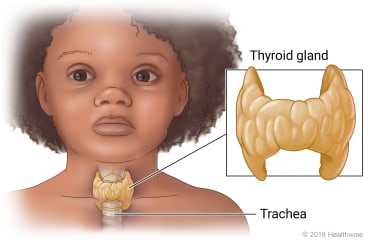 Location of thyroid gland in neck, with detail of thyroid gland