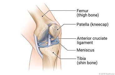 Knee joint, showing the femur, patella, ACL, meniscus, and tibia