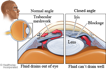 Structures affected by closed-angle glaucoma