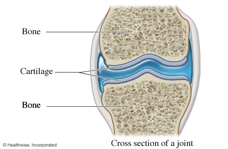 Picture of cartilage (cross section of a joint)