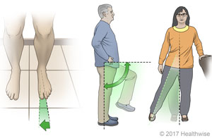 Three examples of safe positions of foot, knee, and leg after surgery