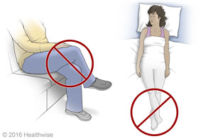 Two examples of wrong ways to cross legs after hip surgery, both sitting and in bed