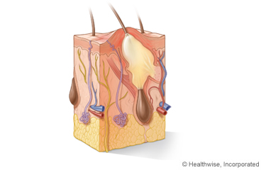 Layers and structures of the skin