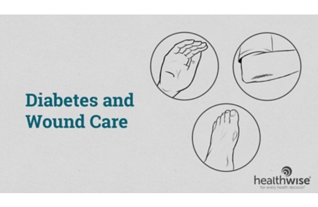 Diabetes and Wound Care