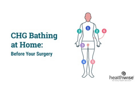 CHG Bathing at Home: Before Your Surgery