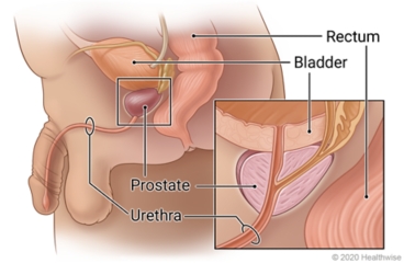 Location of prostate between bladder and urethra in front of rectum, with detail of urethra passing through prostate.